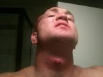 throat-problems.jpg