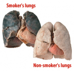 smokers-lungs-comparison.png