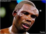 Bump-Head_injury.jpg