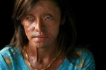 fileacidattackplasticsurgeonhonouredkhjfuebcfagl.jpg