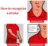 stroke 2.jpg