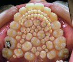 mouthfullofteeth.jpg