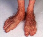 hairyfoot.jpg