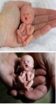 dbl fetus.jpg dbl fetus.jpg
