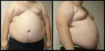 Obesity6.jpg
